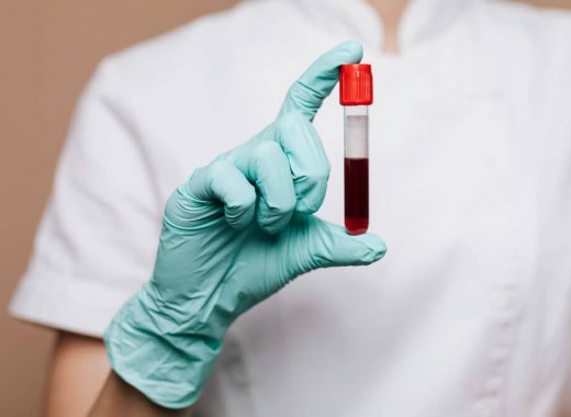Anemia – jakie badania mogą być zalecone chorym z podejrzeniem tego schorzenia?