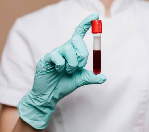 Anemia – jakie badania mogą być zalecone chorym z podejrzeniem tego schorzenia?