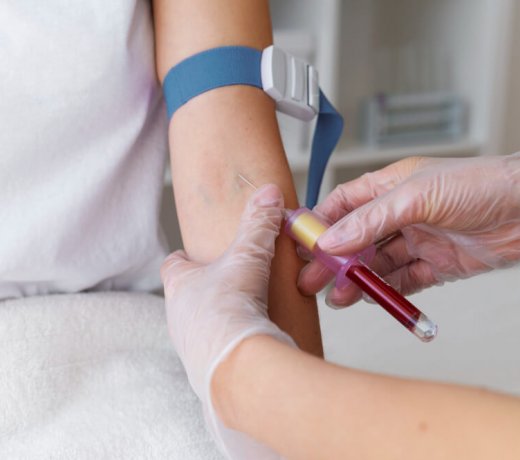 Biochemia krwi i panel cukrzycowy – badania, na które pacjenci zgłaszają się sami